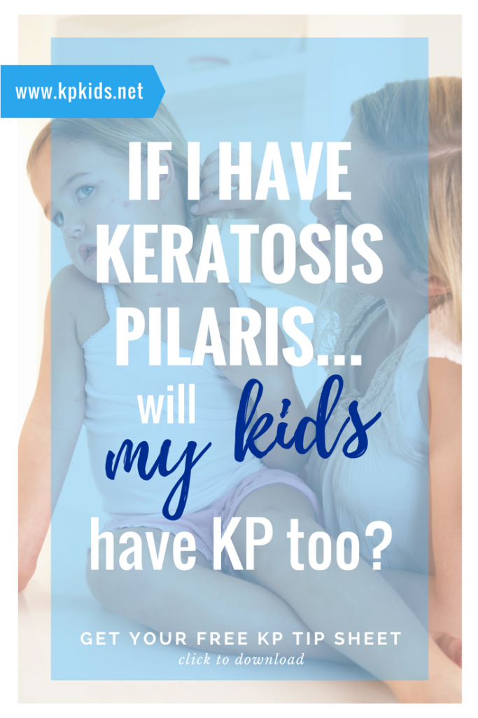 If I Have Keratosis Pilaris, Will my Kids Have KP too? | KPKids.net
