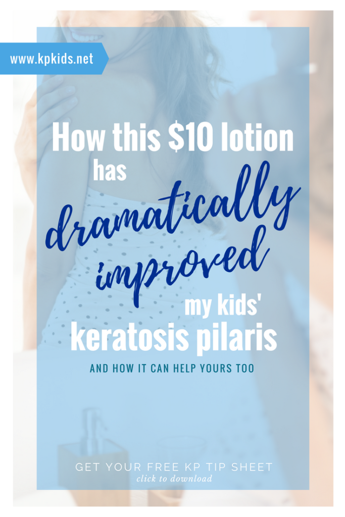 How this $10 Lotion Dramatically Improved my Kids' Keratosis Pilaris | KPKids.net
