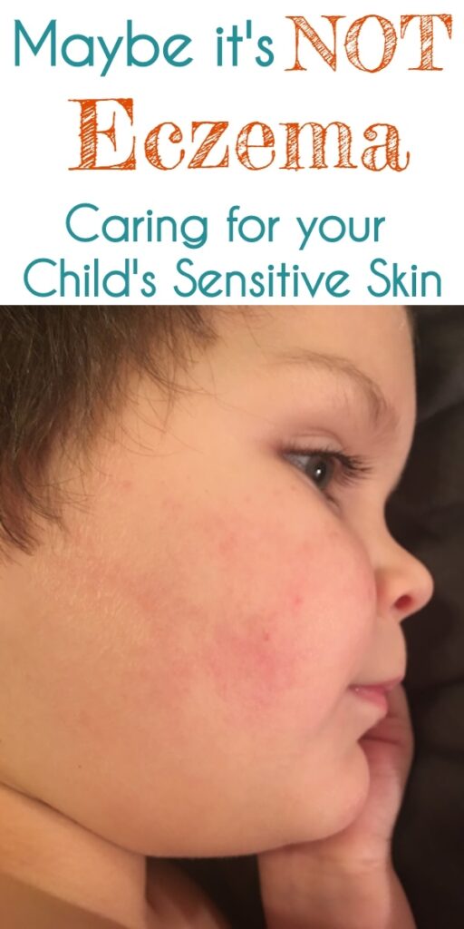 Red & Bumpy Skin: Keratosis Pilaris in Toddlers & Children