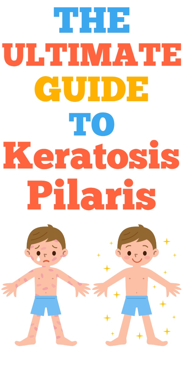 Keratosis Pilaris Treatment: The Ultimate Starter Guide